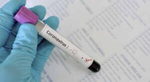 teste coronavirus
